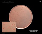 y.enterocolitica on MacConkey agar